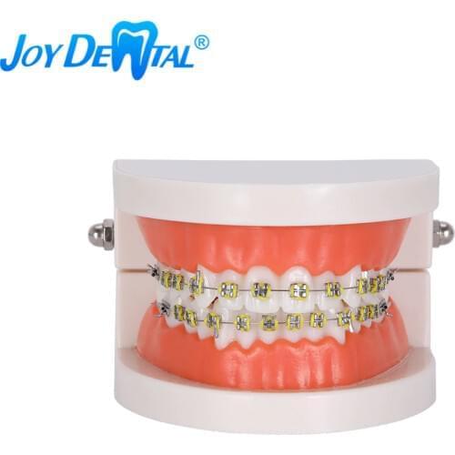 Dental Orthodontic Teeth Model with Metal Brackets Braces School Teaching Equipment