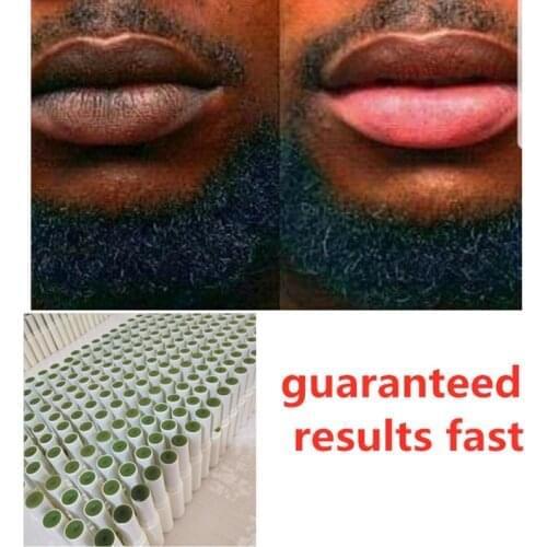 100% Handmade Lips Pink Fresh Lightening Bleaching Balm Treatment Remove Dark Smoke Lips