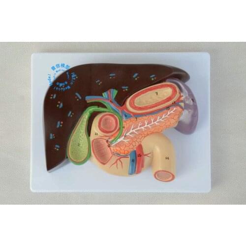 Free shipping&Pancreatic model, liver model, duodenum, gallstone model, anatomical model of spleen, medical