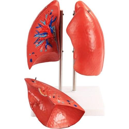 BIX-A1073 Disassembled Human Lung Anatomical Model Medical Teaching Tool