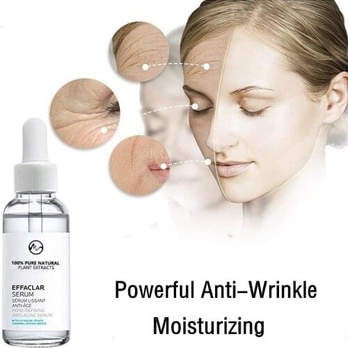 Minch Anti-Wrinkle Face Essence Oil Pore Treatment Serum Blackhead Acne Spots Remover Hyaluronic Acid Vitamin C Serum 10ml