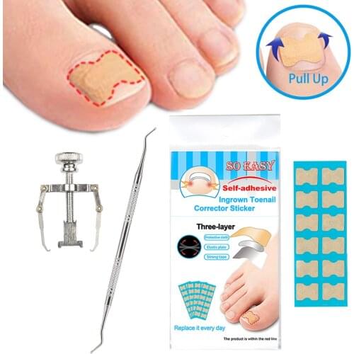 Ingrown Nail Correction Kit Ingrown Toenail Stickers Toe Nail Clamp & Lifter Straightening Treatment Recover Corrector Toe Nail