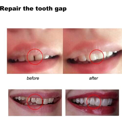 5/10/15/20/30g Temporary Tooth Repair Kit Teeth And Gap FalseTeeth Solid Glue Denture Adhesive Teeth Whitening Tooth Beauty Tool