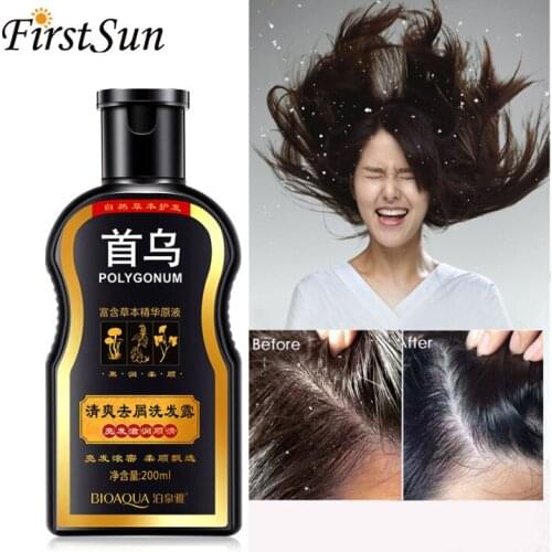 200Ml Shampoo Multiflorum Chinese Herbal Remove Dandruff Anti Hair Loss Shampoo Nourishing Hair Growth Repair Damaged Hair Care