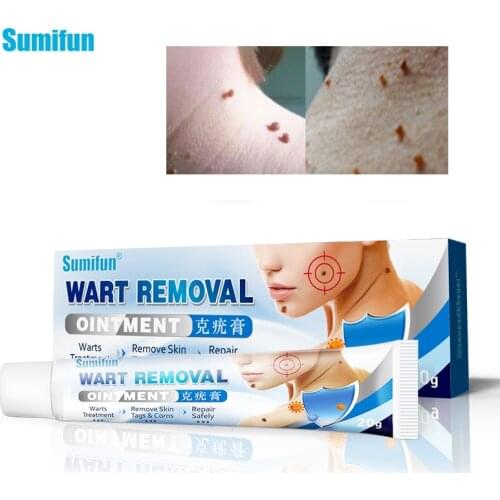 Sumifun Skin Tag Remover Ointment Against Mole & Genital Wart fast Remove Foot Corn Warts Papillomas Rapidly removes moles Cream