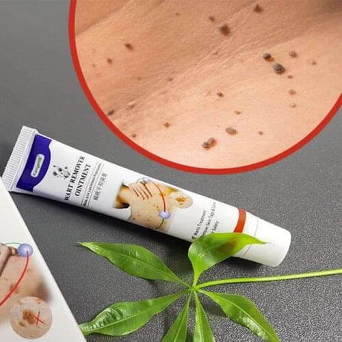 Warts Remover Antibacterial Ointment Wart Treatment Cream Skin Tag Remover