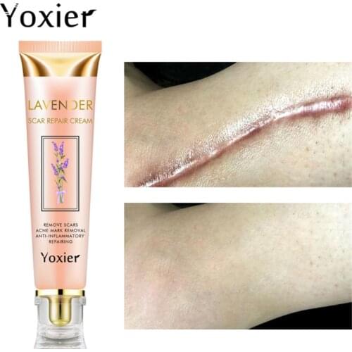 Yoxier Repair Scar Cream Acne Scar Stretch Marks Skin Care Pigmentation Corrector Anti-allergic Calm Whitening Face Cream 1pcs