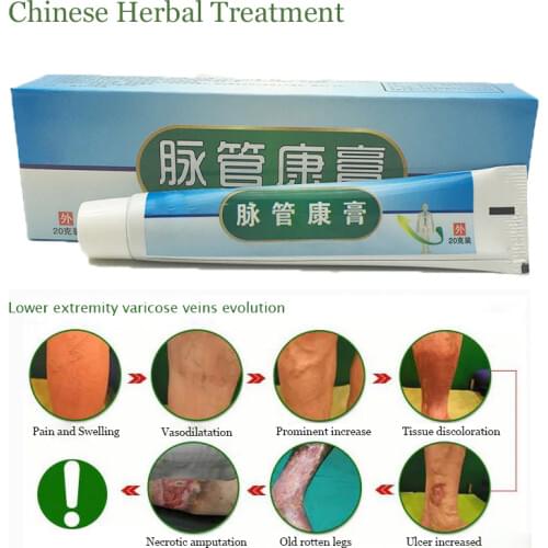 Varicose Veins ointment vasculitis treatment Phlebitis Angiitis inflammation blood vessel Rotten legs Varicose Veins Cream
