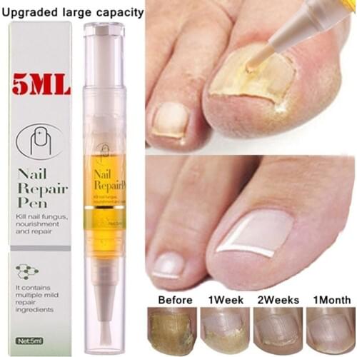 5ml Nail Treatment Liquid Nail Nutrient Liquid Removes Fungus Moisturizing Nail Care Tool Improve Dryness Dullness of Nails