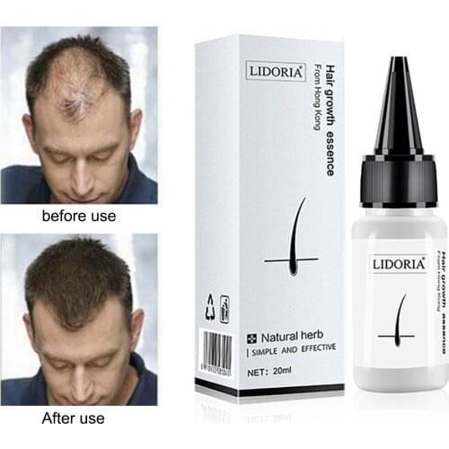 For Men Fast Hair Growth Essence Oil Hair Loss Treatment Help For Hair Growth Serum Repair Shampoo Lador Repair Treatment Dense