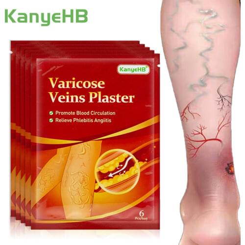 30pcs Varicose Veins Plaster Chinese Medical Patch Vasculitis Phlebitis Spider Leg Pain Skin Care Angiitis Removal Patch A596