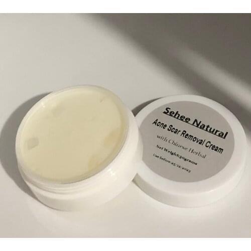 30g Removal Freckle Speckle Age Spots Sunburn Acne Scar Whiten Cream Face Cream