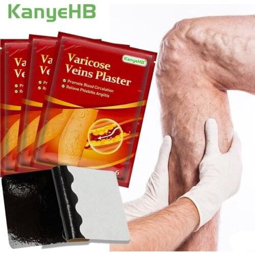 18pcs/3bags Varicose Veins Plaster Vasculitis Phlebitis Treatment Ointment Varicosity Angiitis Removal Herbal Medical Patch A594