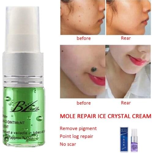 10ml Liquid Mole Removal Pen Skin Tag Remover Pen Natural Health Mole Nevus Wart Skin Tag Foot Corn Warts Treatment