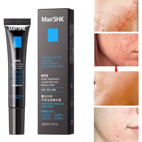 Men Effective Acne Removal Cream Aloe Anti-acne Repair Fade Acne Spots Oil Control Whitening Moisturizing Face Gel Skin Care