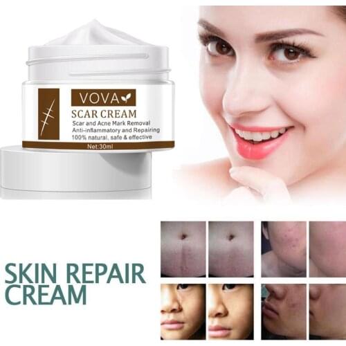 Acne Scar Removal Cream Pimples Stretch Marks Face Gel Remove Acne Smoothing Antibacterial Whitening Moisturizing Body Skin Care