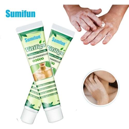 1pcs 20g Vitiligo Treatment Ointment White Spot Psoriasis Cream Mycosis Leukoplakia Chinese Tradition Herbal Medical Plaster