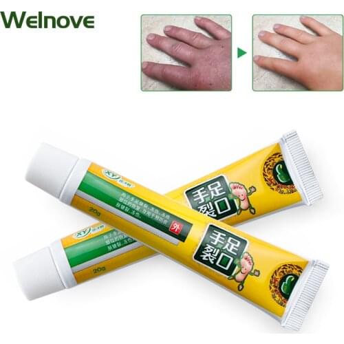 1Pcs Hands Foot Crack Repair Cream Dead Skin Moisturizing Herbal Plaster Anti-Drying Heel Cracked Cream Dry Skin Repair Ointment