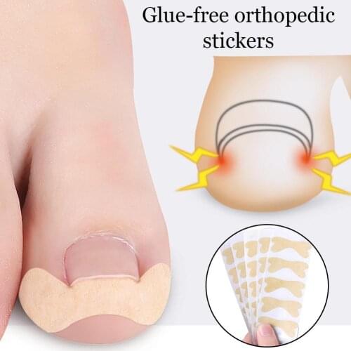 Nail Correction Sticker Relieve Ingrown Toenail Paronychia Glue Curly Toenails Foot Toe Care Nail Correct Recover Tool Repa J4X0