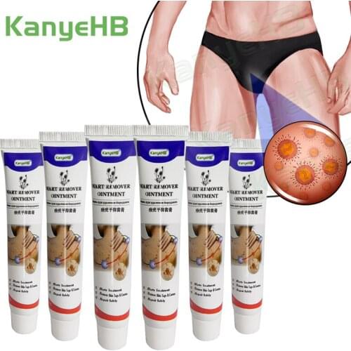 6pcs Genital Warts Cream Penis Warts Remover Ointment Effective Remover All Foot Corn Papilloma Warts Moles Herbs Cream A638