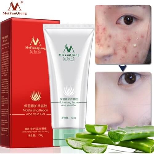 MeiYanQiong Acne Treatment Repair Aloe Vera Gel Natural Plant Extracts Nourish Moisturizing Face Cream Whitening Cream Skin Care