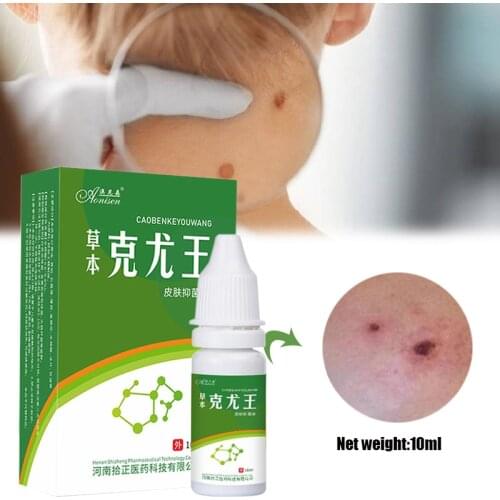 10ml Genital Wart Treatment Papillomas Removal of Warts Liquid From Skin Tags Removing Against Moles Remover Anti Verruca Remed
