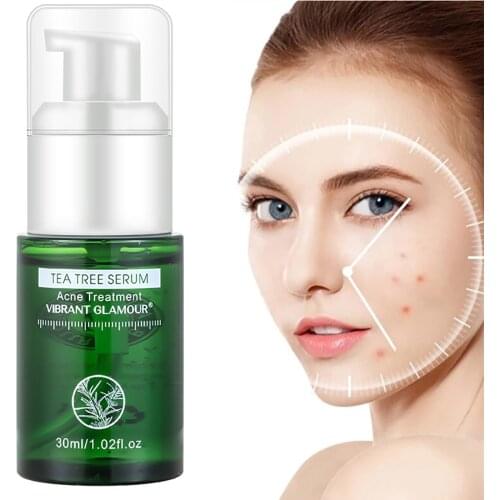 30ml Tea Tree Face Serum Skin Care Essence Acne Removal Treatment Repairing Reduce Acne Traces Soothe Skin