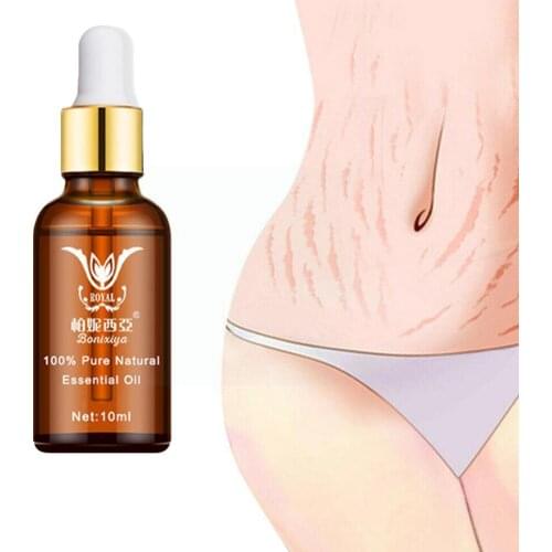 Stretch mark remover essential oil eliminate scars skin treatment anti winkle repair firming pregnancy maternity F8U2