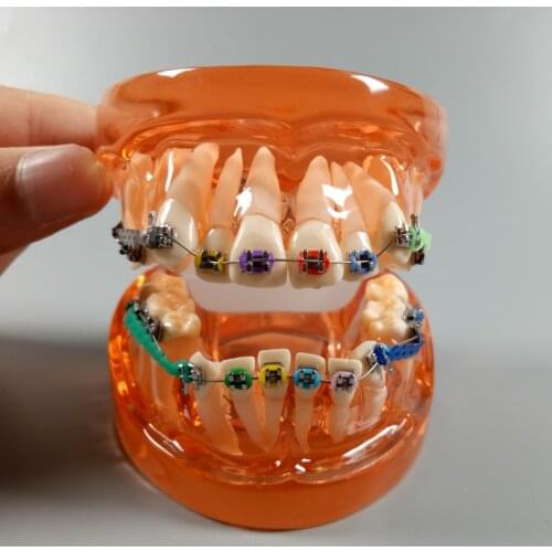 Crystal Dental Study Model Orthodontic Demonstrate Teaching Tool Orange 1 Piece Elastic Ties Chains