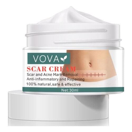 Acne Scar Removal Cream Pimples Stretch Marks Face Cream Remove Acne Smoothing Whitening Moisturizing Body Skin Care 30g