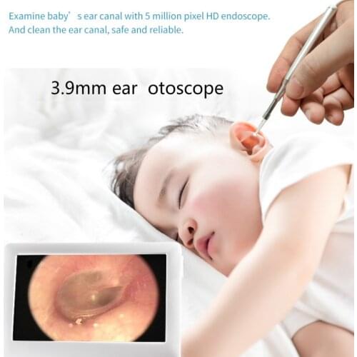 3.9mm in-ear Otoscope with 4.3 Inch Display Ear Inspection Camera Ear Scope with 4 LEDs HD Ear Endoscope 2800maH battery