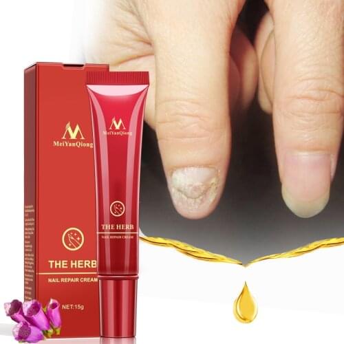 15ml Nail Protector Skin Care Cream Nail Fungus Treatment Herb Nails Repair Cream Nail Care Tools
