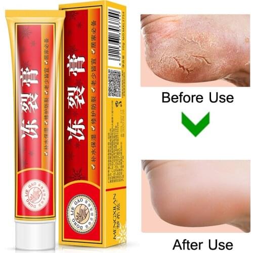 Repairing Moisturizer Foot Cream Anti-chapping Skin For Rough Dry Cracked Chapped Feet Heel Hand Foot Cleft Healing Useful Oil