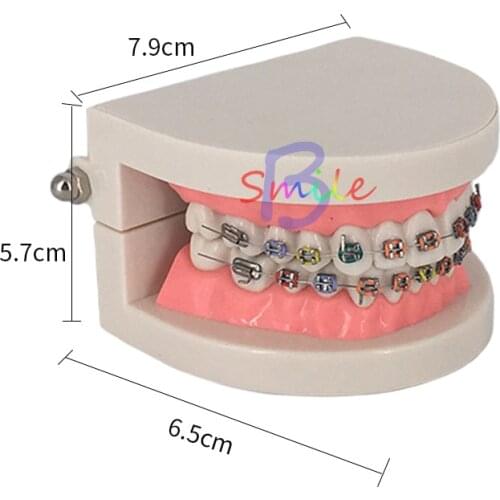 Dental Teaching Tooth Model Treatment With Ortho Metal Ceramic Bracket Arch Wire Buccal Tube Ligature Ties