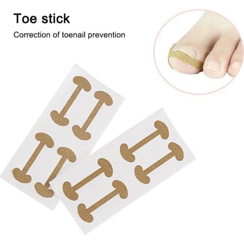 4 Pcs Embedded Stick Pedicure Ingrown Nail Tools Toenail Stickers For Nails Corrector Paronychia Fixer Recover Bunion Feet Care