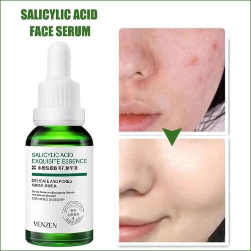 Salicylic Acid Serum Shrink Pores Repair Damaged Skin Moisturize and Hydrate Skin Serum for All Skins