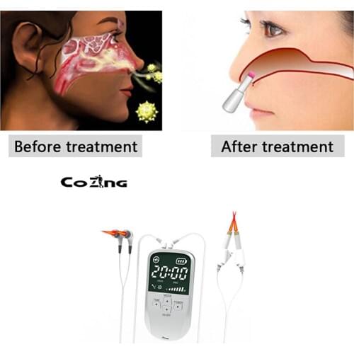 Easy Laser COZING Anti Allergy Reliever Sinus Nose Clean COZING Rhinitis Sinusitis Therapy Massage Health Care Device Cure Hay