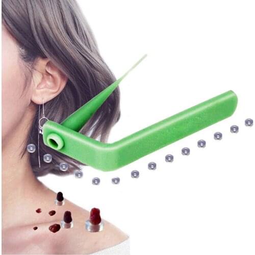 Medical Skin Tag Kill Skin Mole Wart Remover Micro Band Skin Tag Removal Kit With Cleansing remove warts body skin care tools
