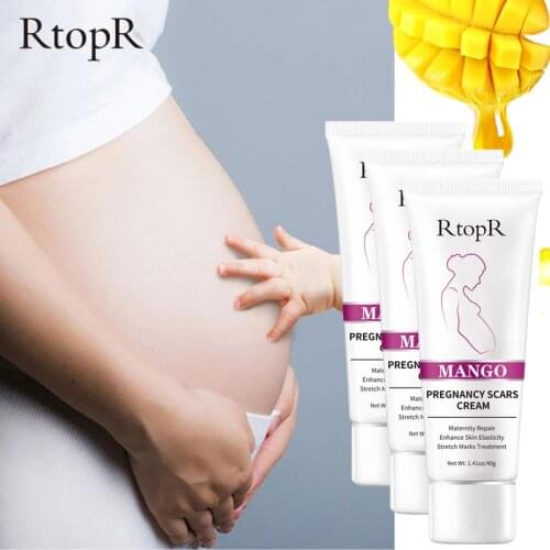Mango Maternal Repair Skin Care Fade Stretch Marks Scar Cream Maternity Anti-Aging Anti-Winkles Treatment Body Firming Cream