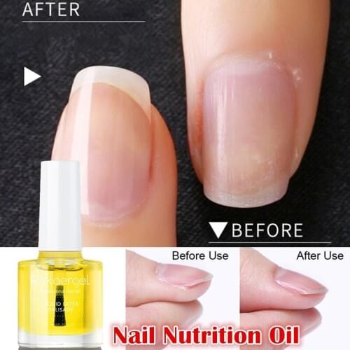7.3ml Nail Cuticle Oil Transparent Cuticle Nutrition Oil Nail Base Oil Nourishing Cuticle Softener Nutritional Fingernail Armor