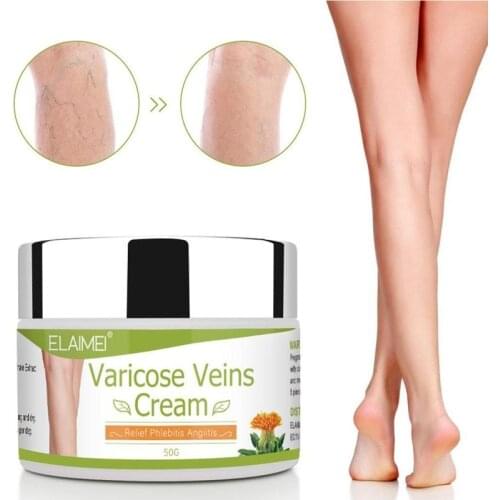 50ml Varicose Vein Ointment Remove Red Blood Streaks Varicosity Veins Angiitis Medical Plaster Vasculitis Phlebitis Spider Cream