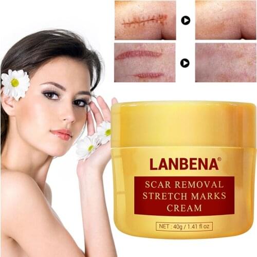 1pc Pigmentation Corrector Face Cream Mark Spots Acne Removal Ointment Cream Moisturizing Whitening Face Cream TSLM1