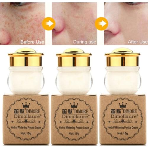 Dimollaure Whitening Cream Removal Speckle Age Spots Freckle Melasma Sunburn Acne Scars Sun Spots Face Cream Kojic Acid Cream