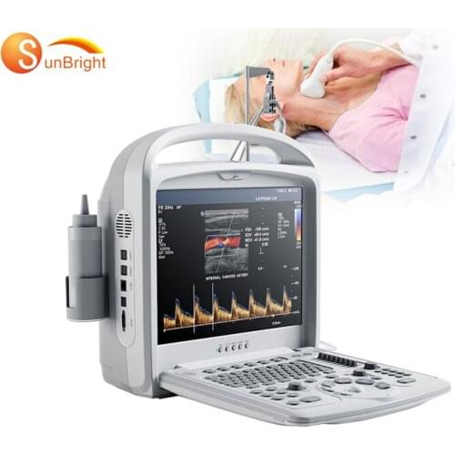 Color doppler CE digital portable color doppler ultrasound medical equipment/cheap doppler ultrasound machine scanner price