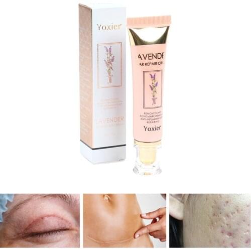 Repair Scar Cream Acne Scar Stretch Marks Repair Cream Pigmentation Corrector Anti-allergic Calm Whitening Skin Care