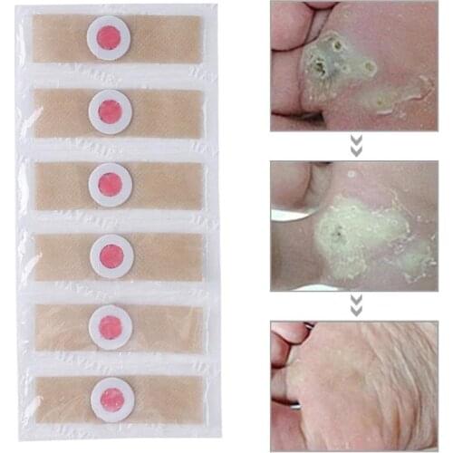 6/12/18/24pcs Foot Care Stickers Chicken Eye Patches Detox Foot Corn Killer Calluses Plantar Thorn Pain Relief Plaster Foot Care