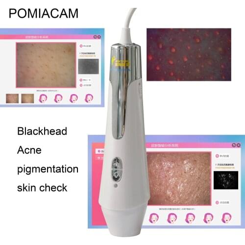 IS6 Digital Microscope Endoscope Camera Microscopio for Skin Inspection