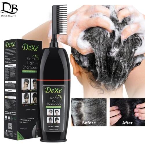 Gold-plating Stainless Steel 540 Needles Roller Micro-needle Therapy Skin Care Tool 0.2mm/0.25mm/0.3mm Needle Length