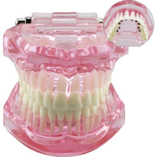 Dental Orthodontic Lingual Bracket Model Typodont M3004