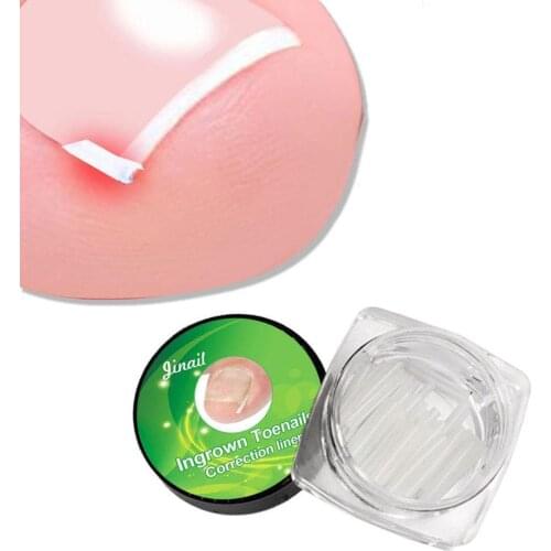 10pcs / lot Silicone Nail Corrector Ingrown Nail Groove Orthopedic Pads Professional Embedded Toenail Adhesive Cushion Foot Care